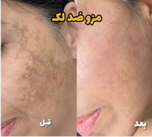 معرفی آموزش خدمات پاکسازی پوست فروزان خواجوی در اهواز در مشاغل ممتاز