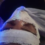 آموزش خدمات پاکسازی پوست فروزان خواجوی در اهواز