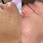آموزش خدمات پاکسازی پوست فروزان خواجوی در اهواز