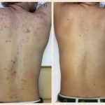 آموزش خدمات پاکسازی پوست فروزان خواجوی در اهواز