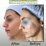 آموزش خدمات تخصصی پاکسازی پوست مائده شلیجی در قائمشهر