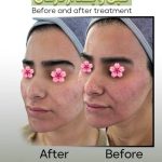 آموزش خدمات تخصصی پاکسازی پوست مائده شلیجی در قائمشهر