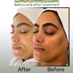 آموزش خدمات تخصصی پاکسازی پوست مائده شلیجی در قائمشهر