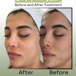 آموزش خدمات تخصصی پاکسازی پوست مائده شلیجی در قائمشهر