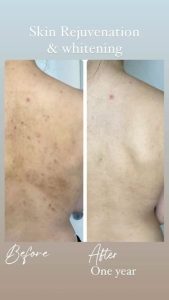 معرفی آموزش خدمات فیشال پوست فروزان خواجوی در اهواز در مشاغل ممتاز