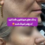 کلینیک زیبایی سیب سربی در اراک