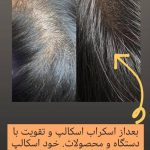مرکز تخصصی پاکسازی پوست گلامور در ارومیه