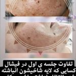 مرکز تخصصی پاکسازی پوست گلامور در ارومیه