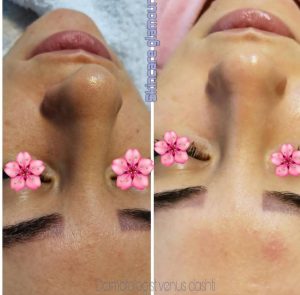 معرفی مرکز تخصصی پاکسازی پوست گلامور در ارومیه در مشاغل ممتاز
