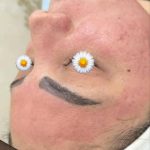 مرکز تخصصی پاکسازی پوست گلامور در ارومیه