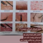 مرکز تخصصی پاکسازی پوست گلامور در ارومیه