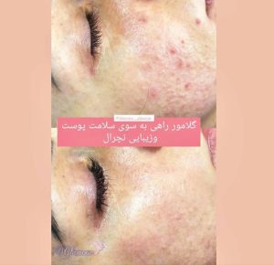 معرفی آموزش خدمات تخصصی پاکسازی پوست ونوس دشتی راد در ارومیه در مشاغل ممتاز