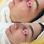 آموزش خدمات تخصصی پاکسازی پوست ونوس دشتی راد در ارومیه