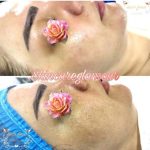 آموزش خدمات تخصصی پاکسازی پوست ونوس دشتی راد در ارومیه