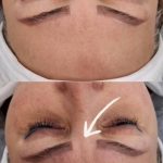 آموزش پاکسازی پوست فیشال مریم شکری در عظیمیه کرج