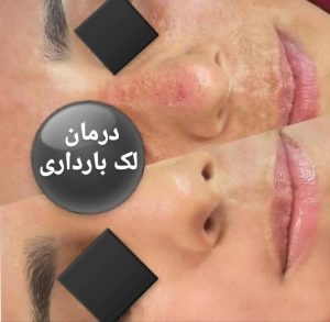 معرفی کلینیک تخصصی پوست مو هیلار در تهران در مشاغل ممتاز