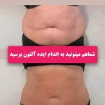 کلینیک زیبایی سیب سربی در اراک