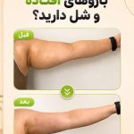 کلینیک زیبایی سیب سربی در اراک