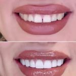 جراح و دندانپزشک دکتر الهه کلوند در کرج