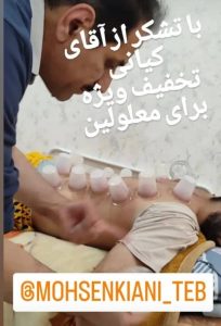 معرفی فصد خون سنتی کیانی در شهریار در مشاغل ممتاز