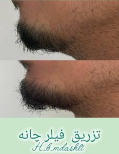 معرفی کلینیک زیبایی مریم دشتی در مهرشهر کرج در مشاغل ممتاز