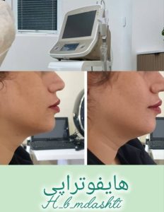 معرفی کلینیک زیبایی مریم دشتی در مهرشهر کرج در مشاغل ممتاز