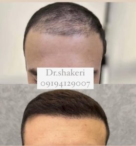 معرفی کلینیک زیبایی دکتر محمدعلی شاکری در تهران در مشاغل ممتاز