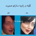 کلینیک زیبایی دکتر محمدعلی شاکری در تهران