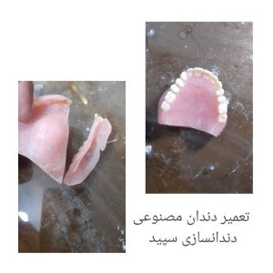 معرفی دندانسازی رجب پور در چابکسر در مشاغل ممتاز