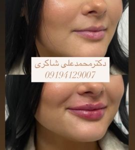 معرفی کلینیک زیبایی دکتر محمدعلی شاکری در تهران در مشاغل ممتاز