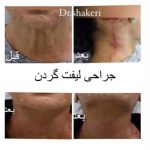 کلینیک زیبایی دکتر محمدعلی شاکری در تهران