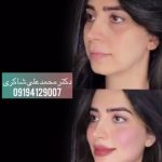 کلینیک زیبایی دکتر محمدعلی شاکری در تهران