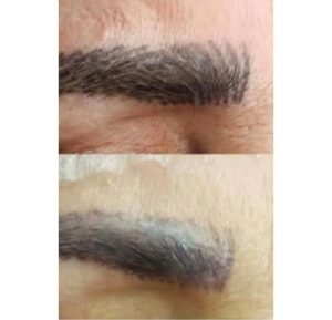 معرفی خدمات لیزر شکری در عظیمیه کرج در مشاغل ممتاز