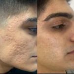 خدمات لیزر شکری در عظیمیه کرج