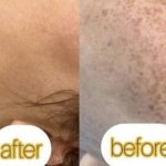 خدمات لیزر شکری در عظیمیه کرج