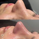 مرکز فیشیال تالگو مینا خلیلی در قم