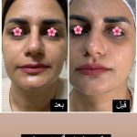 خدمات تخصصی پاکسازی پوست شیما مصطفوی در بابل