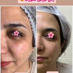 خدمات تخصصی پاکسازی پوست شیما مصطفوی در بابل