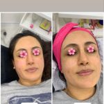 خدمات تخصصی پاکسازی پوست شیما مصطفوی در بابل