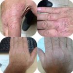 خدمات فیشال درمانی پوست ساناز خواجوی فرد در بوشهر