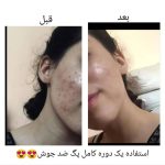خدمات فیشال درمانی پوست ساناز خواجوی فرد در بوشهر