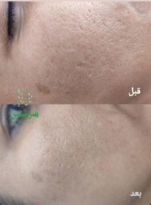 معرفی خدمات فیشال درمانی پوست ساناز خواجوی فرد در بوشهر در مشاغل ممتاز
