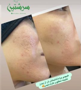 معرفی خدمات فیشال درمانی پوست ساناز خواجوی فرد در بوشهر در مشاغل ممتاز