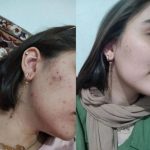 خدمات فیشال درمانی پوست ساناز خواجوی فرد در بوشهر