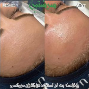 معرفی خدمات فیشال درمانی پوست ساناز خواجوی فرد در بوشهر در مشاغل ممتاز