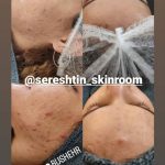 خدمات فیشال درمانی پوست ساناز خواجوی فرد در بوشهر
