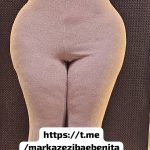 کلینیک تخصصی حجم دهی سینه و باسن بنیتا در شرق تهران