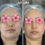کلینیک زیبایی پوست و مو آرزو در اسدآباد