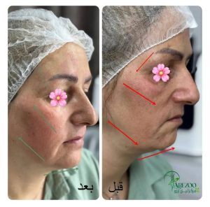 معرفی کلینیک زیبایی پوست و مو آرزو در اسدآباد در سامانه مشاغل ممتاز
