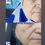 کلینیک زیبایی پوست و مو آرزو در اسدآباد